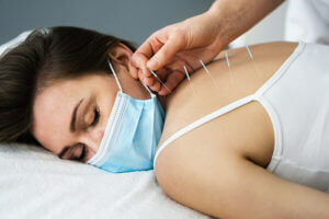 dry needling therapy maine treatment at reform physical therapy